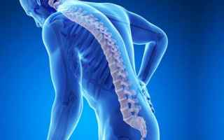 osteoporosi  curare osteoporosi
