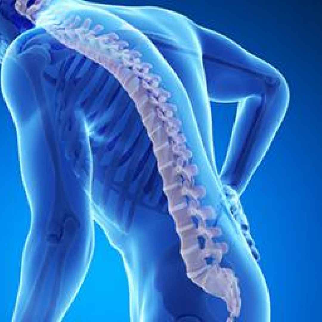 osteoporosi  curare osteoporosi