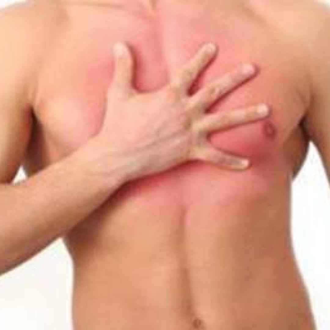 ушиб груди у мужчины (120) фото