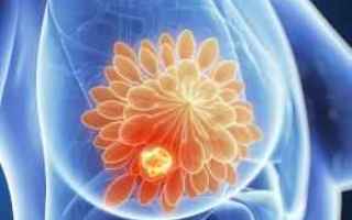 Salute: tumore al seno  tumori