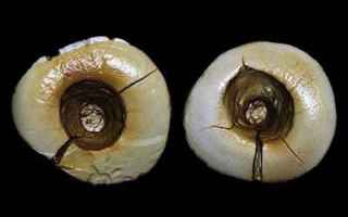 Storia: preistoria garfagnana denti otturazione