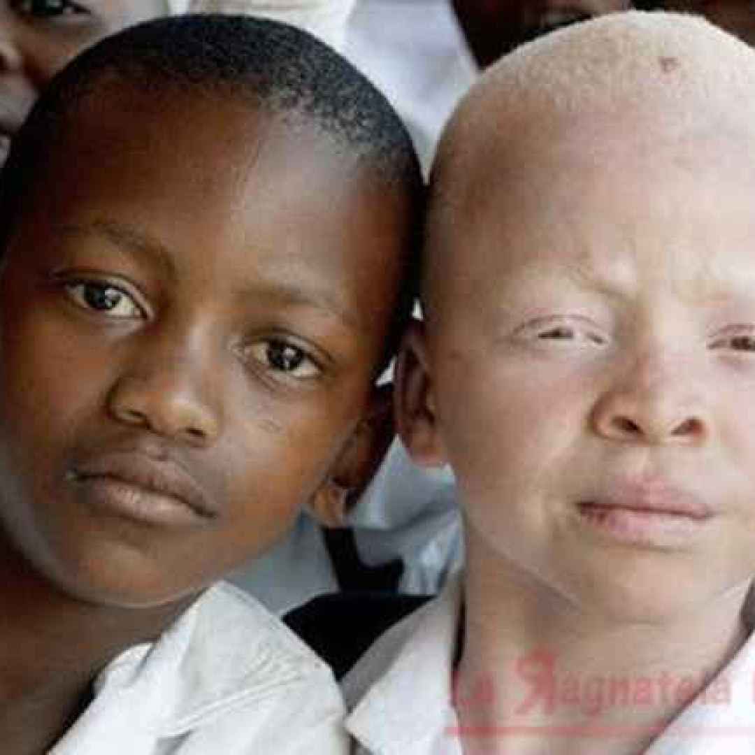Ragazzo Albino ucciso in Monzambico, tra crudeltà e Sciamani