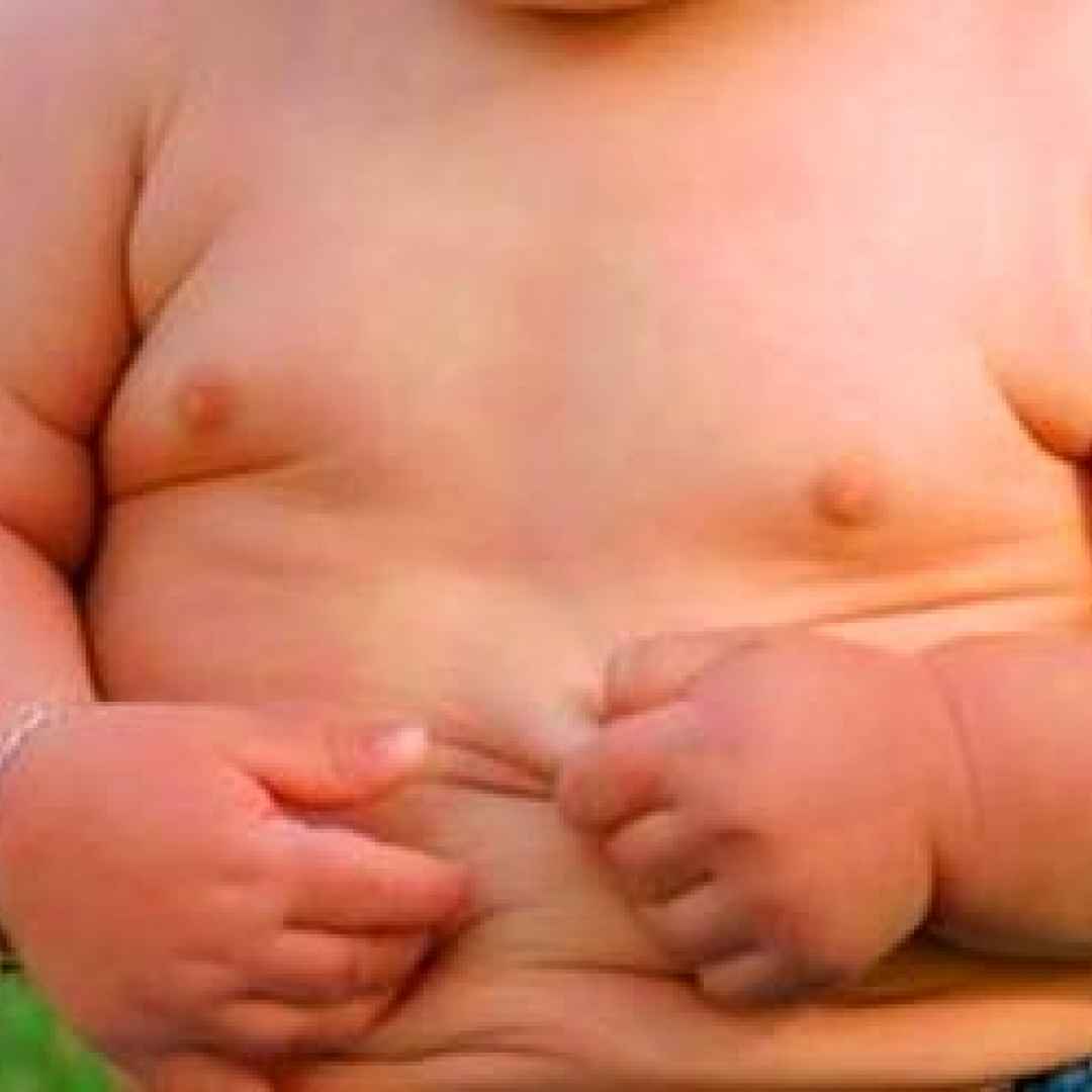 obesità  bambini