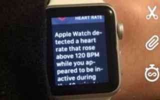 Calcio: apple watch  smartwatch