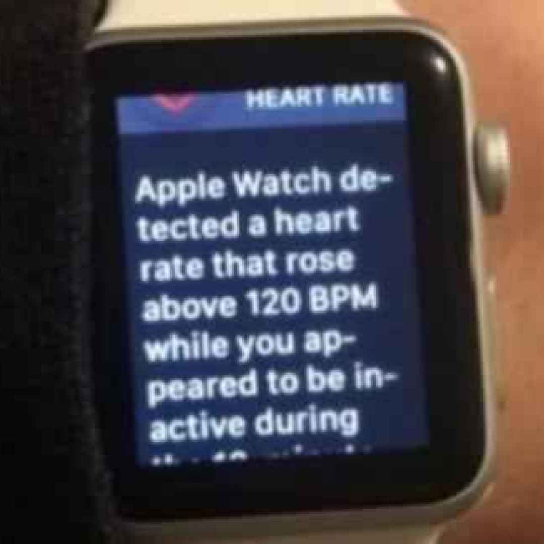 apple watch  smartwatch