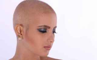 Medicina: alopecia
