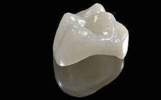 Medicina: capsula  dentale  dentaria  dente  finto