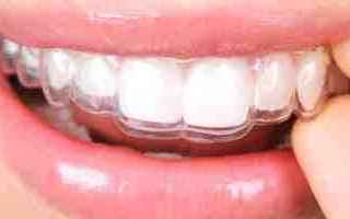 bite  placca  trasparente  denti