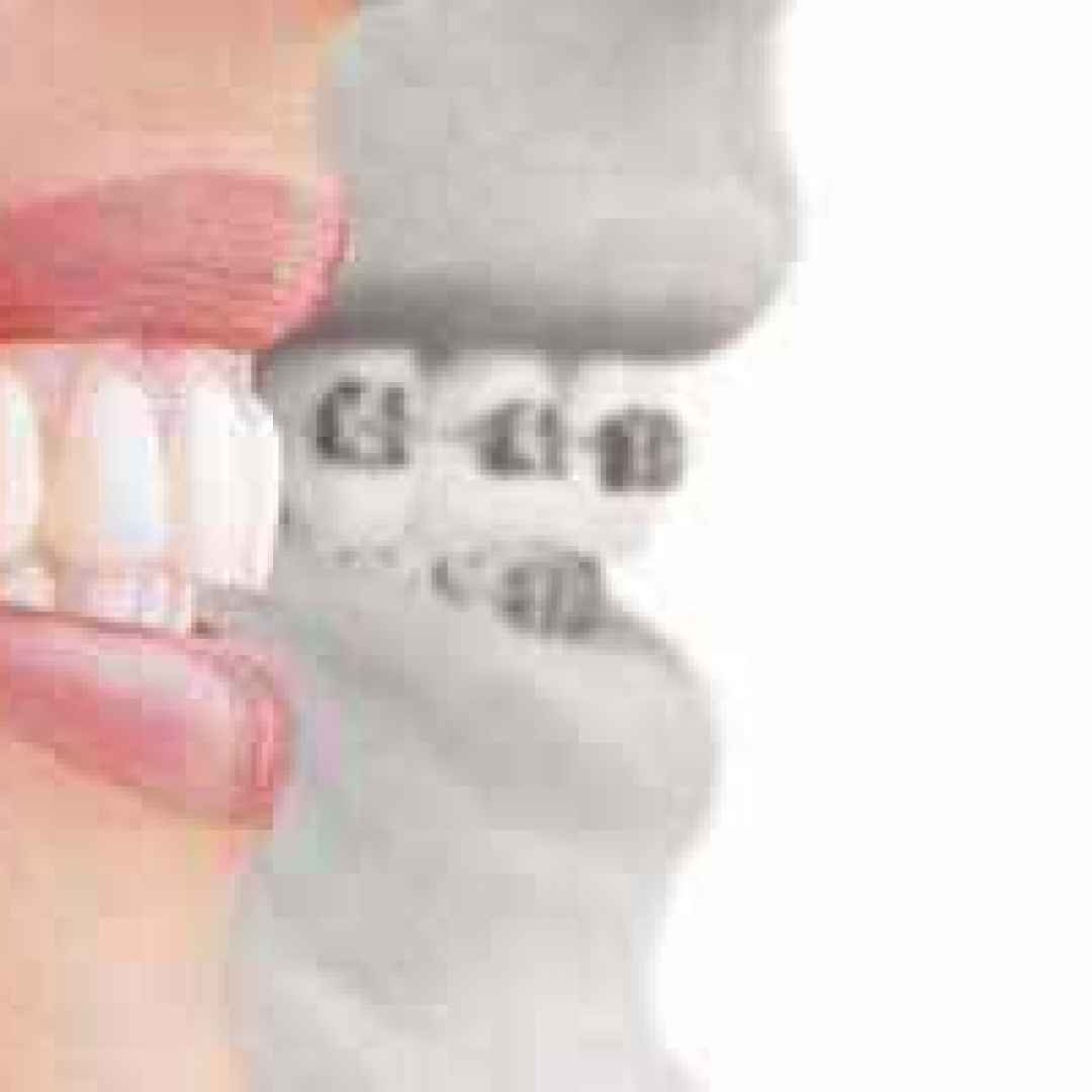 apparecchi  denti  ortodontici