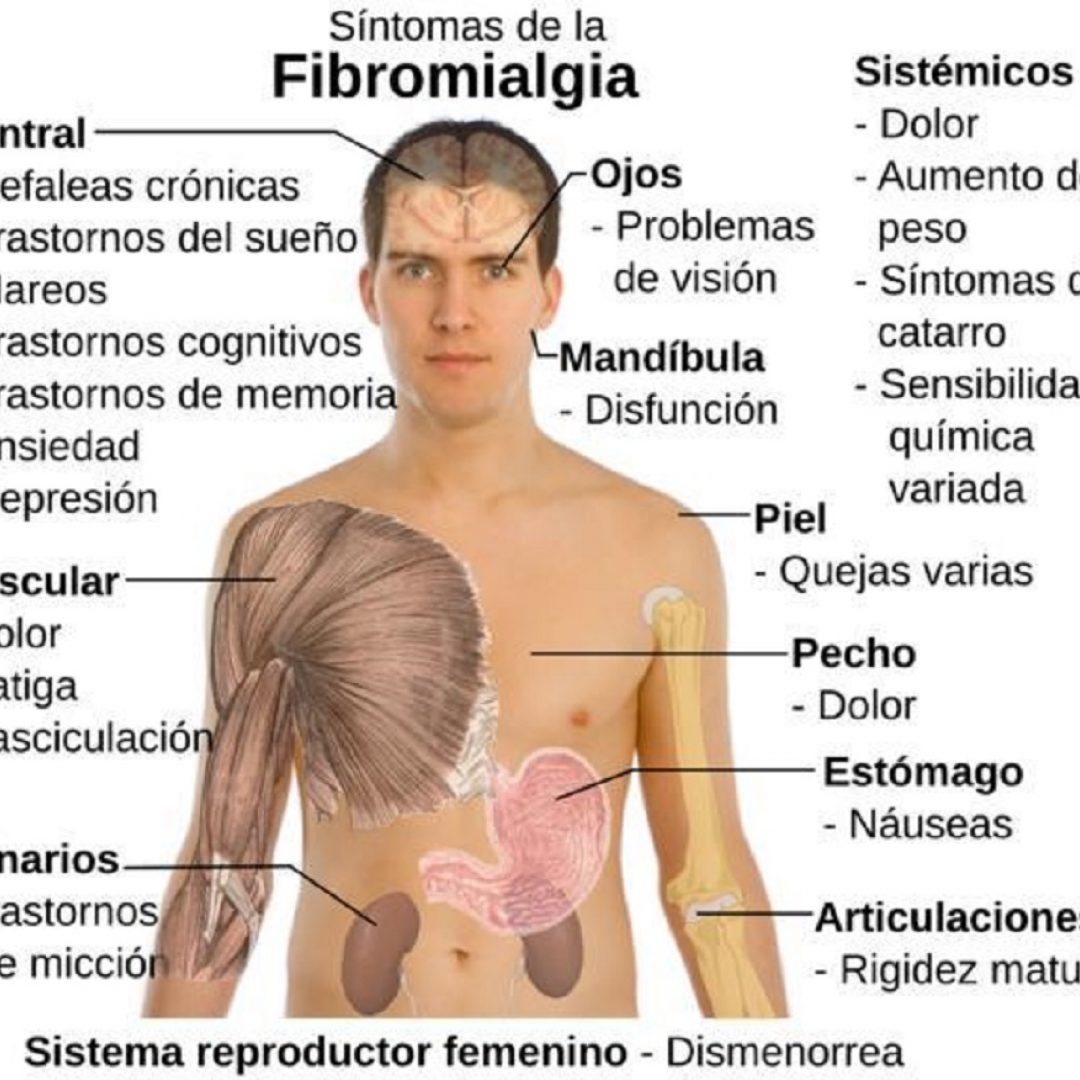 fibromialgia  malattie