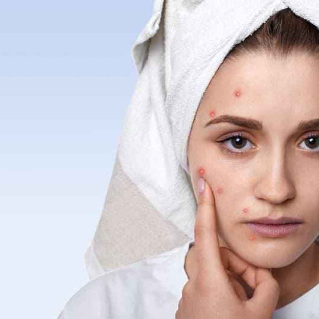pulizia viso acne prodotti
