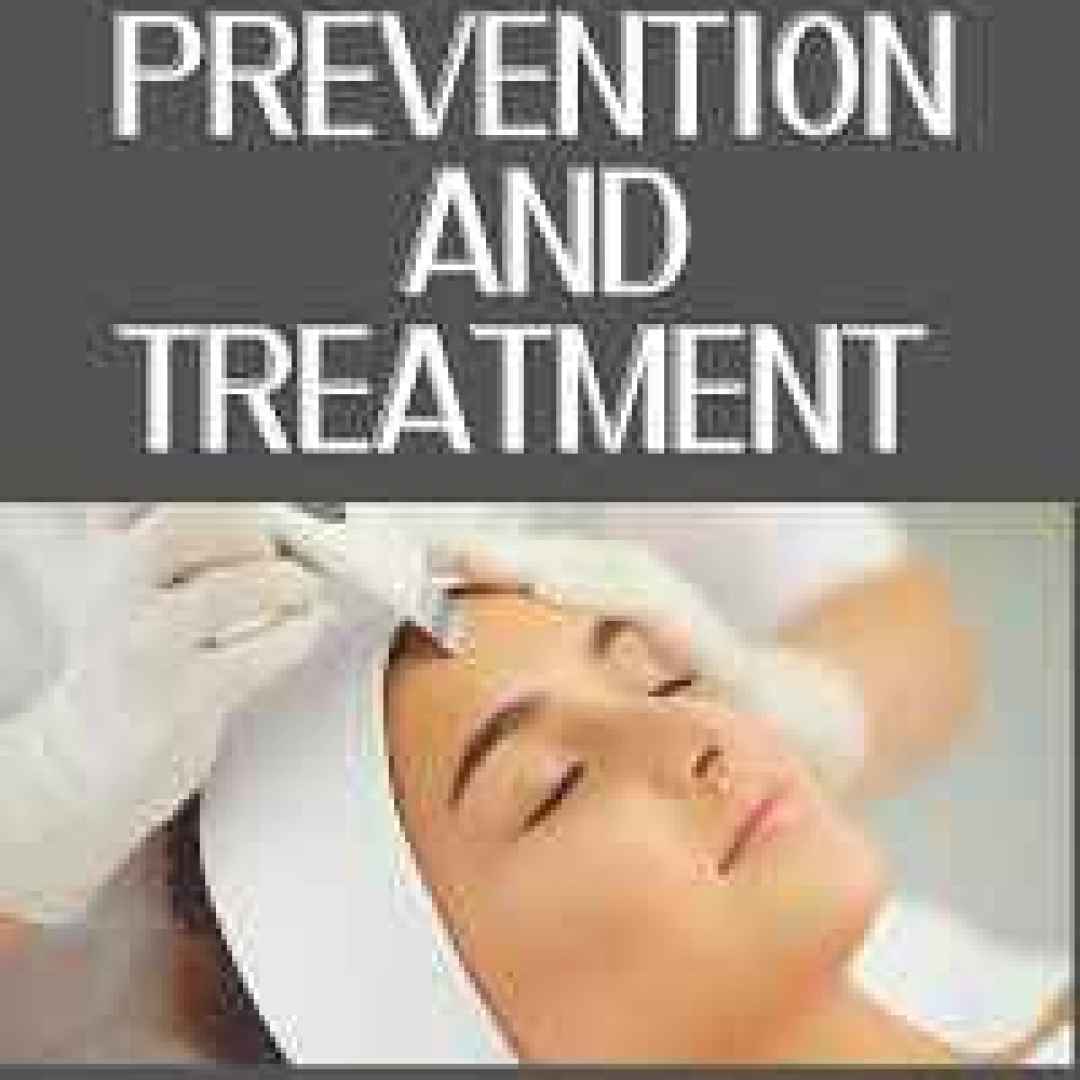 acne  acne treatment  acne medicine