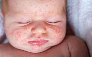 Medicina: lassativi  neonati  allergie