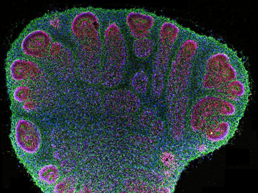 Organoidi cerebrali umani, palline di tessuto nervoso sotto il millimetro, hanno imparato a riconoscere le lettere Braille. Ogni lettera arriva come schema di impulsi elettrici e dopo un po' la risposta a una A smette di somigliare a quella di una B. Un cervello ha 86 miliardi di neuroni, loro qualche centinaio di migliaia, e lo scenario più vicino è un esame clinico.